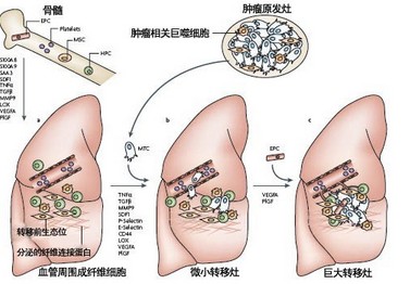 输卵管肿瘤图