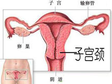宫颈息肉病因