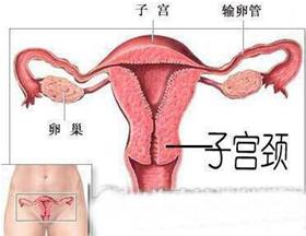 宫颈炎症状